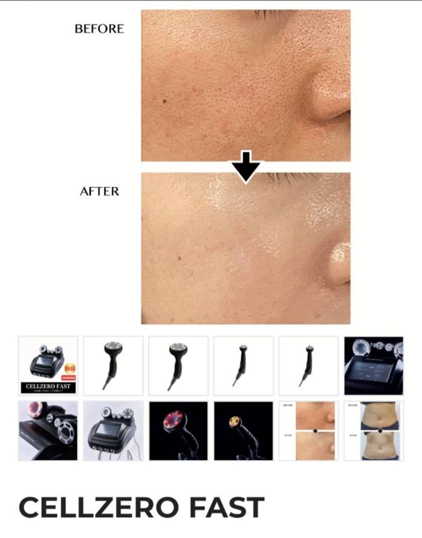 ほぼ新品　人気商品　CELLZERO FAST セルゼロファスト