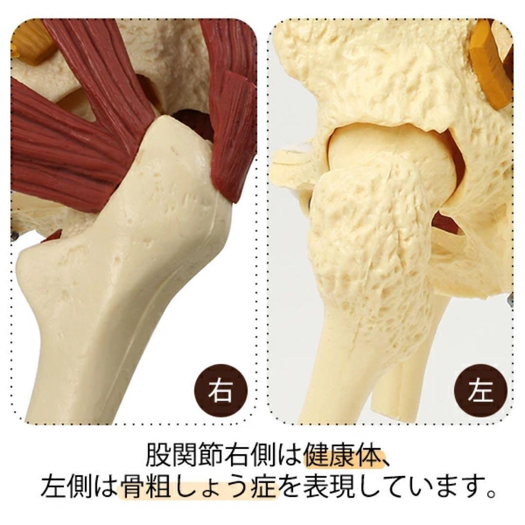 〈7ウェルネ〉脊椎模型 (主要筋・靭帯・神経、血管付) 実物大