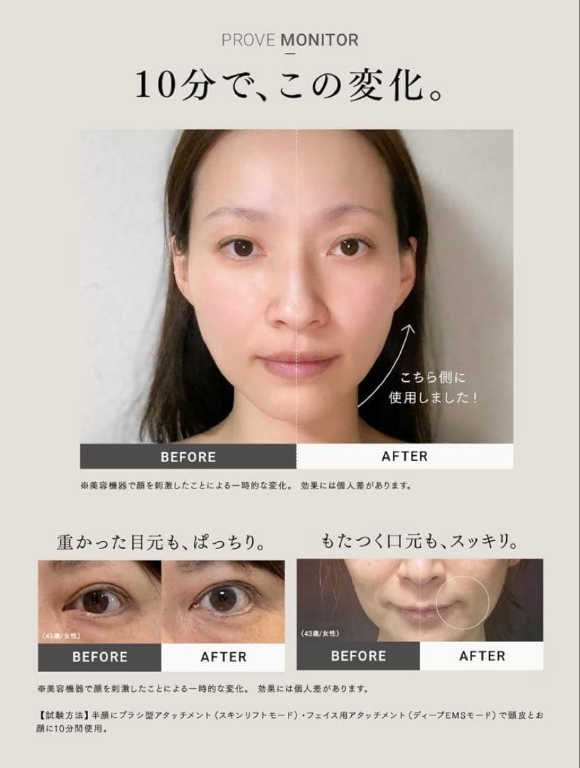 最先端EMS美顔器 MYTREX PROVE