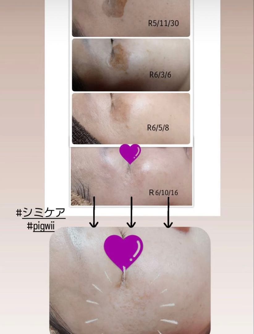 けぃ シミケア　機械