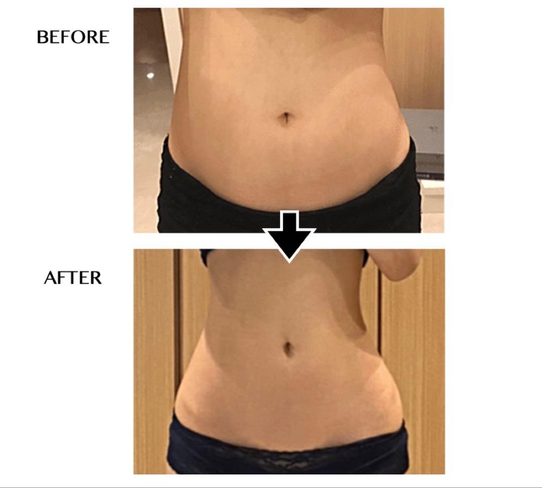 ⭐︎＼自分磨きキャンペーン／セルゼロバッグ 自分deエステ　痩身マシン　RF