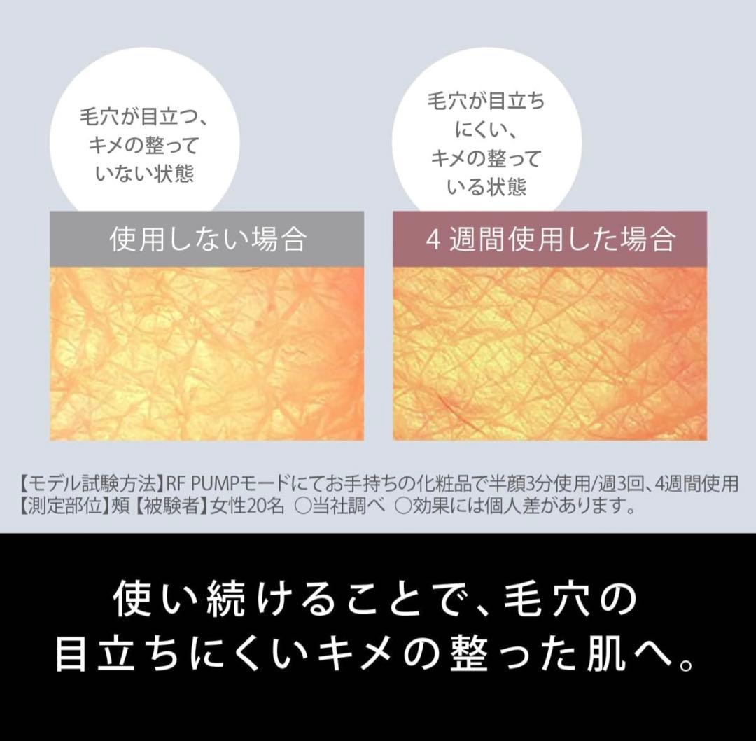 みえみえ 美品 バイタリフトRF・EMS・イオン搭載 EH-SR85-K